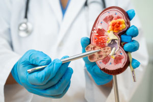 Chirurgie Urologique