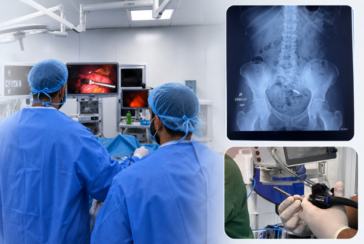 CHIRURGIE DE L'OBÉSITÉ ET MÉTABOLIQUE Premières interventions de Bipartition MagDI™ en Afrique